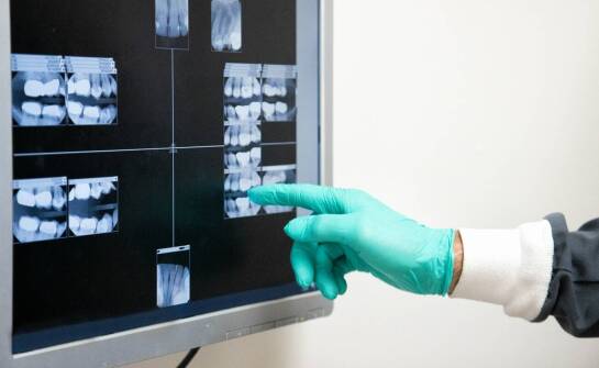 Jak przebiega tomografia komputerowa zębów i jakie są jej zalety?