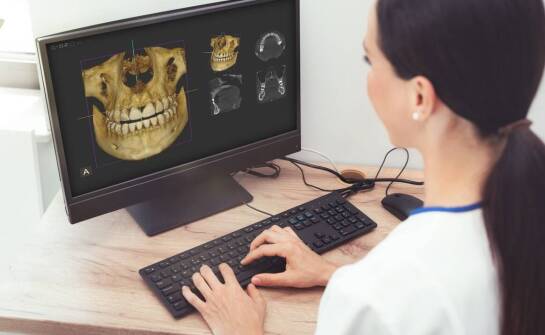 Czym jest tomografia komputerowa zębów i jakie daje korzyści pacjentom