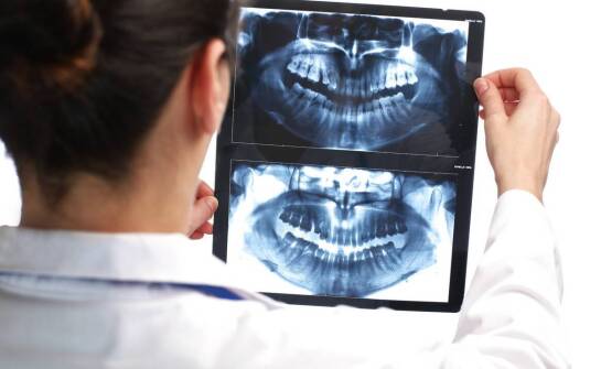 Tomografia komputerowa zębów – jak wpływa na leczenie stomatologiczne