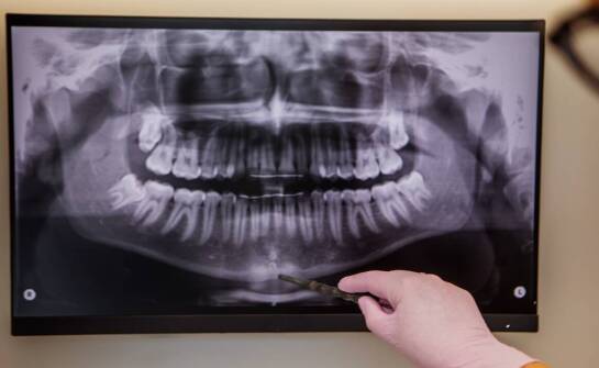 Tomografia komputerowa zębów – jak wspiera nowoczesną diagnostykę jamy ustnej