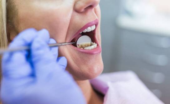 Wybielanie zębów – najczęstsze pytania, mity i fakty dotyczące zabiegu