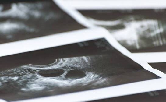 Zdjęcie pantomograficzne – jak przebiega badanie i jakie daje możliwości