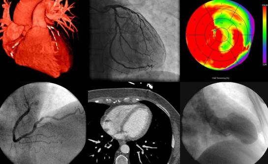Zdjęcie pantomograficzne – co wykrywa i w jakich sytuacjach jest potrzebne