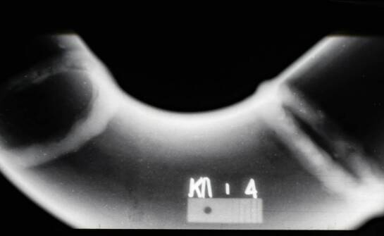 Zdjęcie pantomograficzne – znaczenie, przebieg i możliwości wykorzystania