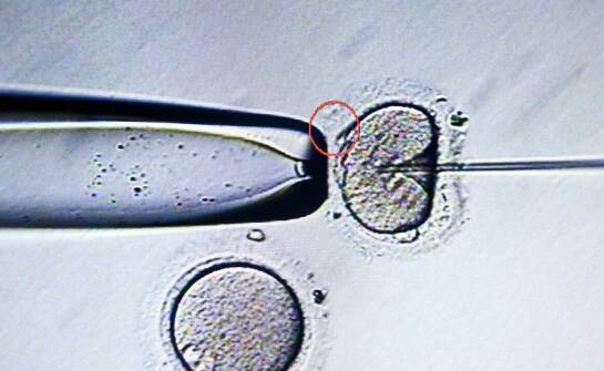 Zdjęcie pantomograficzne – jakie informacje pozwala uzyskać i kiedy się je wykonuje