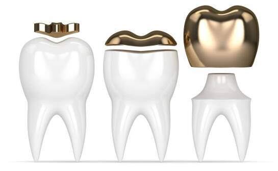 Zalety oraz ograniczenia stosowania protez zębowych – najczęstsze pytania