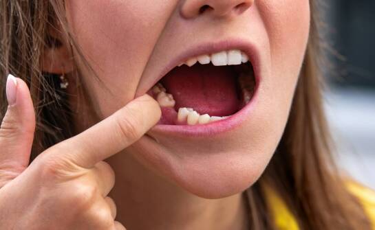 Jak przebiega leczenie ortodontyczne i jakie efekty można osiągnąć?