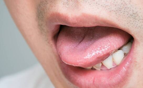 Aparaty na zęby – jak przebiega leczenie i jakie efekty można uzyskać