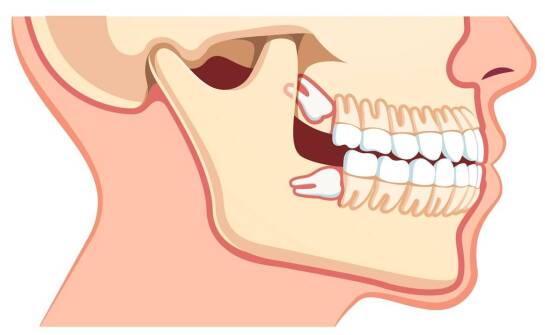 Czym zajmuje się ortodonta i kiedy warto skorzystać z leczenia ortodontycznego