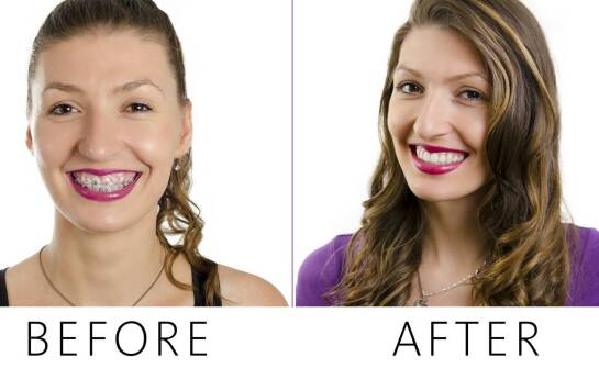 Najczęstsze wady zgryzu u dzieci i dorosłych – jak przebiega leczenie ortodontyczne