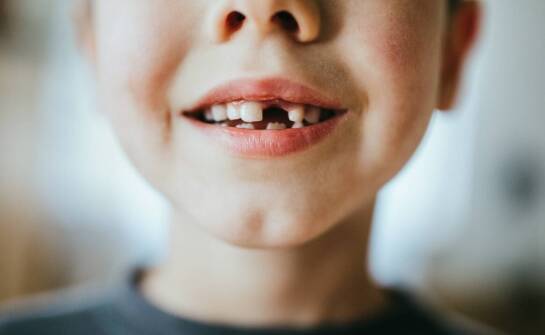 Najczęstsze pytania o leczenie ortodontyczne – odpowiedzi i najważniejsze fakty