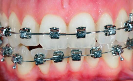 Listwy zębate – zastosowania, budowa i kluczowe zalety w napędach mechanicznych