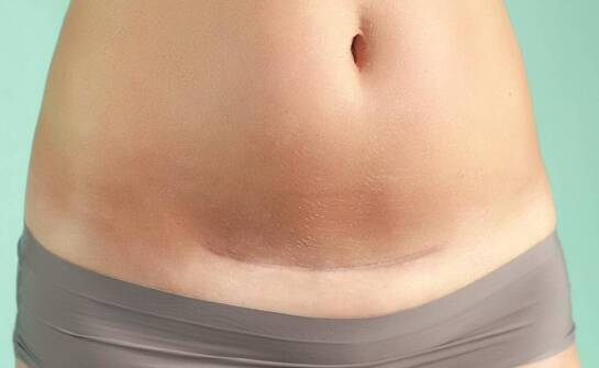 Wonder – innowacyjne podejście do badań prenatalnych i zdrowia kobiet