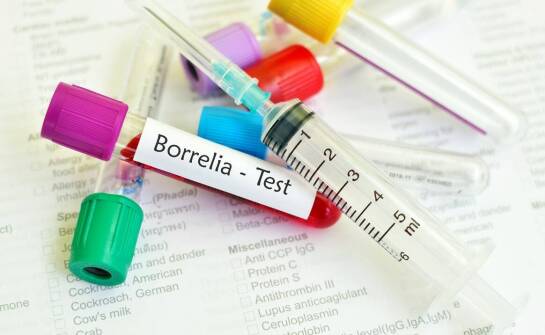 Borelioza – typowe objawy, przebieg zakażenia i znaczenie wczesnej diagnostyki