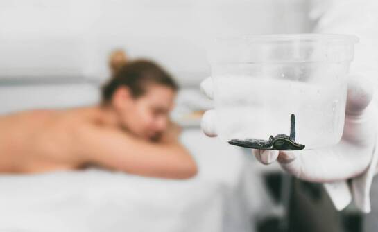 Pijawki w terapii – historia, mechanizmy działania i najnowsze doniesienia