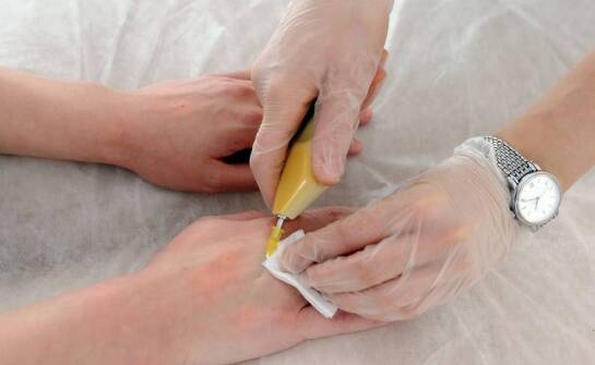 Pijawki w medycynie – działanie, wskazania oraz efekty terapii hirudoterapią