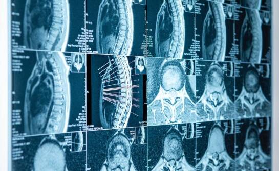 Pasożyty w organizmie – jak biorezonans wspomaga wykrywanie i walkę