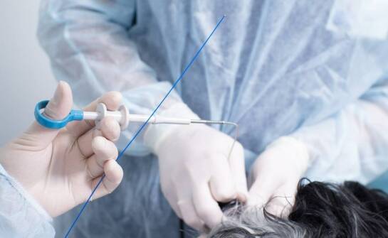 Pijawki w leczeniu – mechanizmy działania i wpływ na zdrowie organizmu