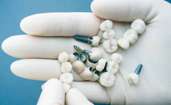 Implanty stomatologiczne – kiedy warto rozważyć leczenie i jakie są zalety
