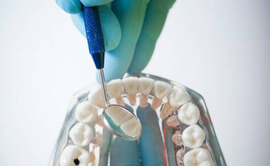 Implanty zębów – najważniejsze fakty, wskazania i bezpieczeństwo zabiegów