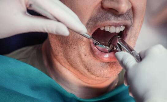 Endodoncja – jak współczesne metody leczenia ratują naturalne zęby