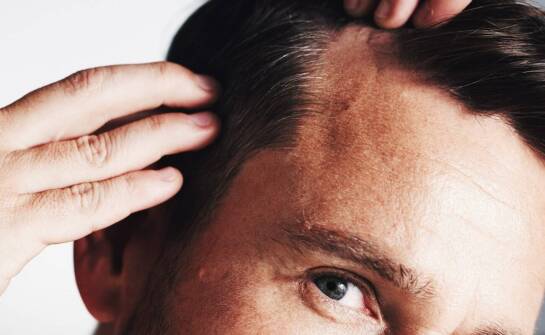 Łysienie plackowate – najnowsze metody leczenia i wsparcie trychologa