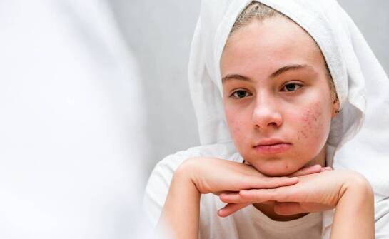 Łuszczyca skóry – najważniejsze informacje o przyczynach i możliwościach leczenia