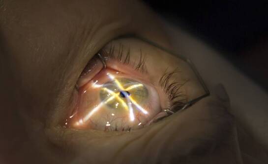 Angiografia oka – na czym polega badanie i w jakich przypadkach się je wykonuje