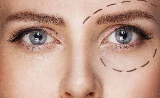 Korekta powiek górnych i dolnych – przebieg zabiegu oraz możliwe rezultaty