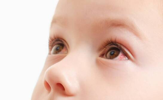 Zatkany kanał łzowy u niemowląt – objawy, możliwe powikłania i leczenie