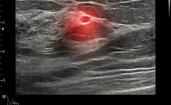 Zaćma wrodzona – najważniejsze fakty, możliwe konsekwencje i leczenie