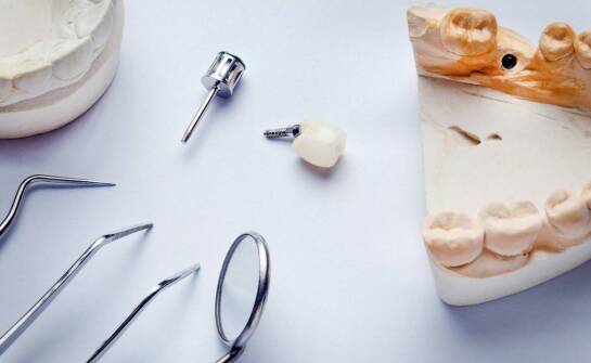 Implanty stomatologiczne – najważniejsze informacje i etapy leczenia zębów