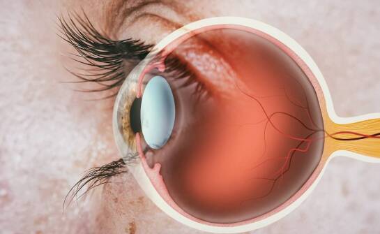 Zaćma wtórna – jak ją rozpoznać, jakie są przyczyny i możliwe skutki