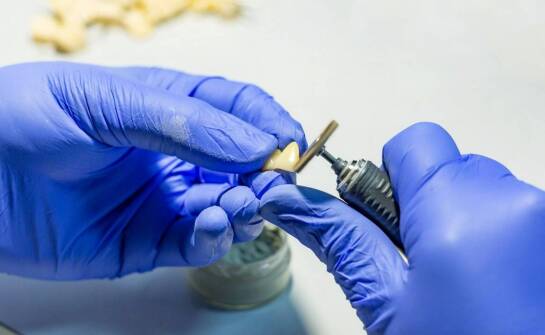 Implanty zębowe – najważniejsze informacje, zalety i etapy leczenia