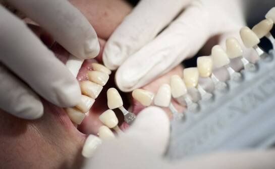 Implanty a naturalne zęby – podobieństwa, różnice i kluczowe korzyści