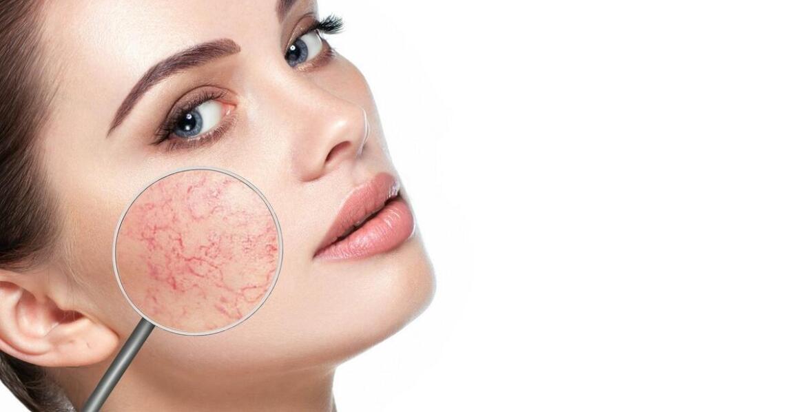 Kwas hialuronowy – zastosowanie, efekty i bezpieczeństwo zabiegów kosmetycznych