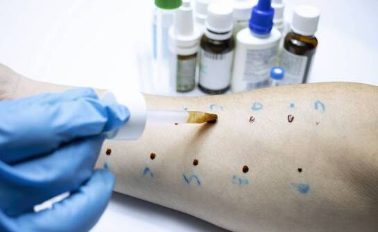 Jak rozpoznać warrozę i dlaczego zagraża zdrowiu rodzin pszczelich