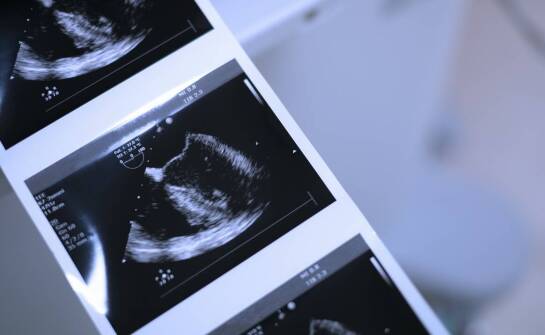 USG główki u noworodków – kiedy warto wykonać i na co zwrócić uwagę