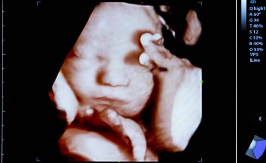 USG główki noworodka – przebieg badania i najważniejsze korzyści diagnostyczne