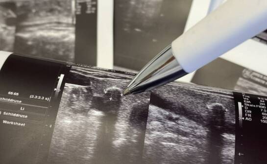 Zastosowanie i znaczenie USG w diagnostyce chorób – co warto wiedzieć