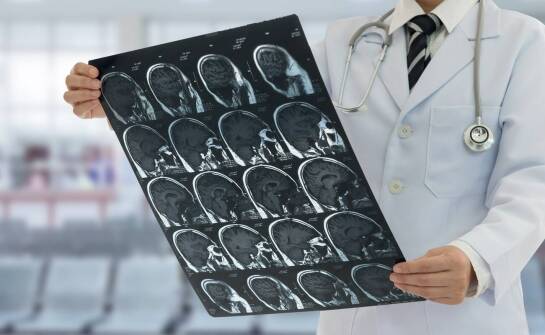 Czym zajmuje się neurolog i jakie objawy mogą wskazywać na choroby układu nerwowego