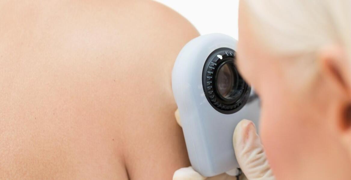 Jakie korzyści przynosi regularne korzystanie z trichoskopii?