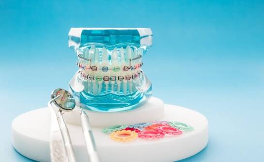 Wybór odpowiednich narzędzi ortodontycznych – na co zwrócić uwagę?