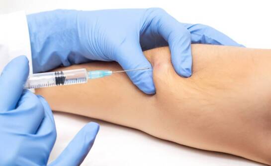 Terapia kolagenowa a mało inwazyjne leczenie stawów