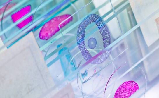 Siateczki do mikroskopii: kluczowy element w analizach mikrobiologicznych