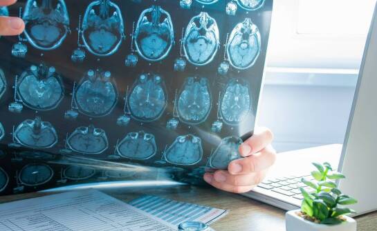 Jakie techniki obrazowe są najskuteczniejsze w diagnozie zespołu cyklopa?