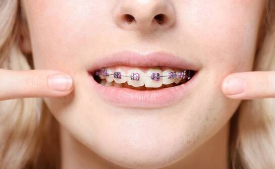 Czy korekta wad zgryzu zawsze wymaga noszenia aparatu?