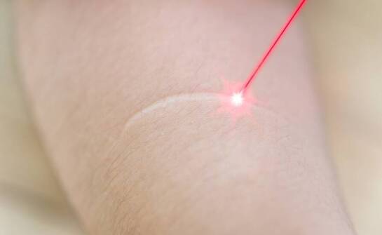 Zastosowanie laseroterapii w dermatologii estetycznej – co oferuje rynek?