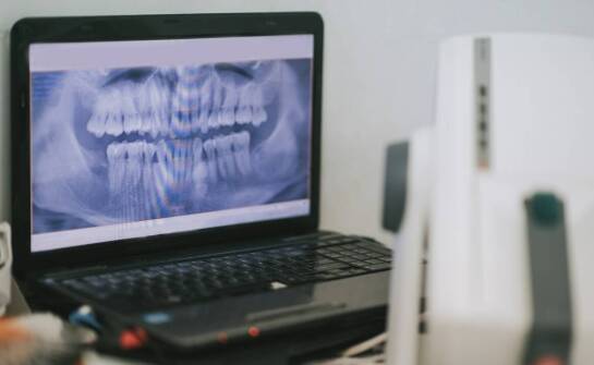 Przewaga cyfrowej radiowizjografii w diagnostyce stomatologicznej