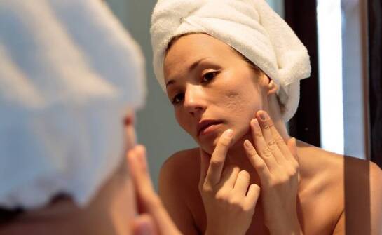 Jak medycyna estetyczna może pomóc w leczeniu blizn potrądzikowych?